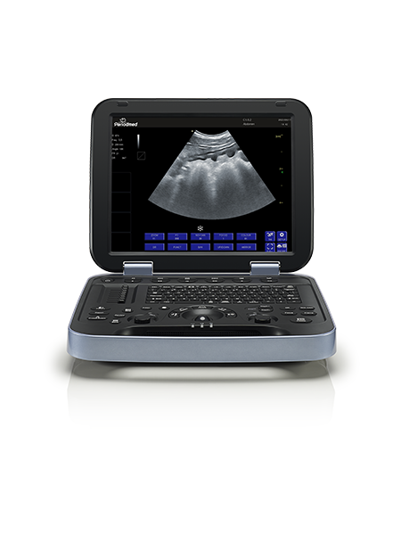 PU-VDL153A Veterinary Color Doppler Ultrasound Machine for General Practice PU-VDL153A Veterinary Color Doppler Ultrasound Machine for General Practice