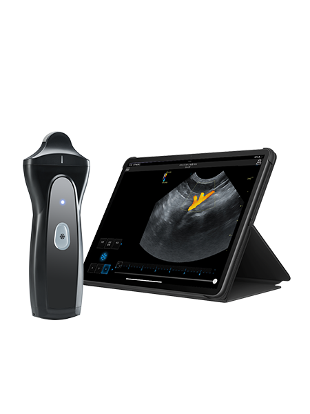 Wireless Handheld Ultrasound Device VPAU1D Wireless Handheld Ultrasound Device VPAU1D