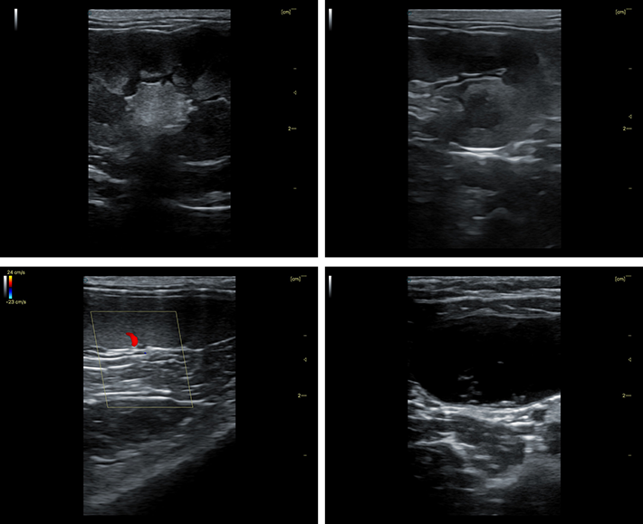Clear Ultrasound Imaging