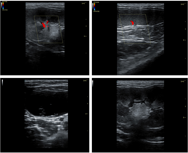 Excellent Imaging Performance