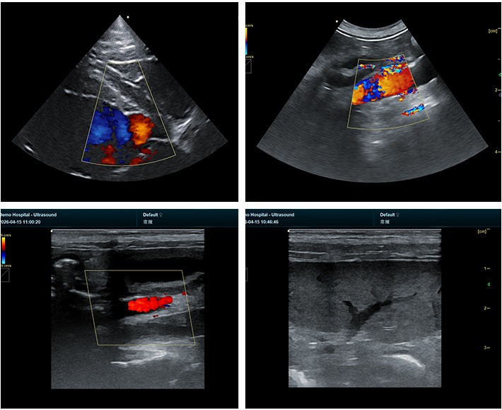 Clear Ultrasound Imaging